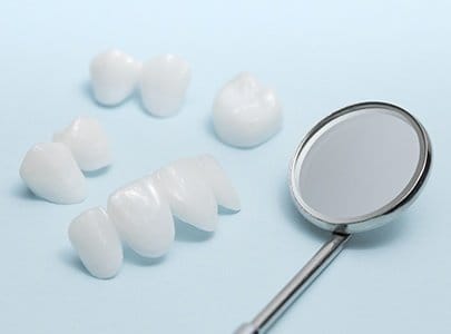 Several metal free dental restorations prior to placement