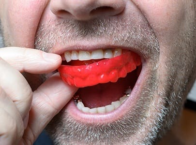 Person placing red athletic mouthguard