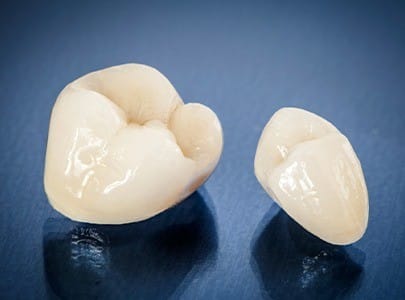 Two tooth-colored dental crowns prior to placement