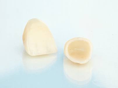 Close-up of two CEREC dental crowns in Cary, NC