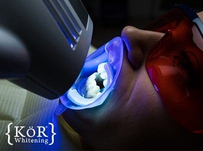 Patient receiving in-office teeth whitening