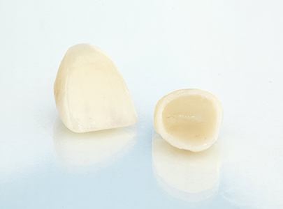 Two porcelain dental crowns sitting on reflective surface