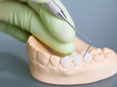 Closeup of Cary dentist crafting dental bridge