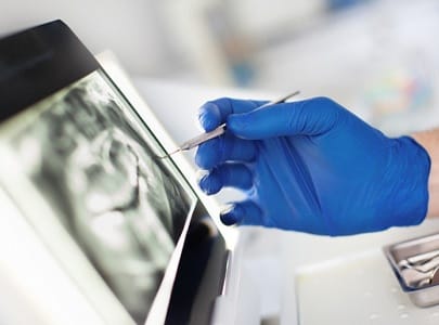 Implant dentist in Cary examining X-ray on a computer