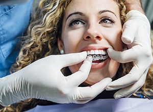 Smiling woman getting Invisalign in Cary