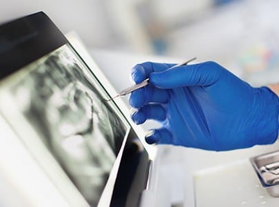 Digital dental x-rays on tablet computer