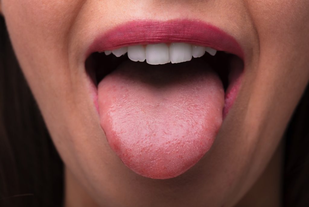 Woman’s tongue