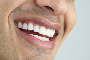 Close-up of a man’s smile with white teeth
